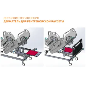 кровать медицинская mb-95.1 (электропривод) с дополнительными опциями