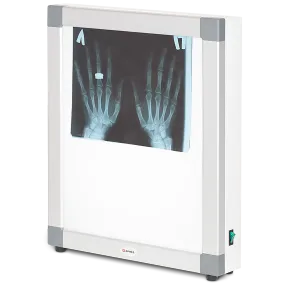 негатоскоп общего назначения 1-кадровый